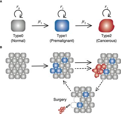 Mathematical Modeling of Locoregional Recurrence Caused by Premalignant Lesions Formed Before Initial Treatment